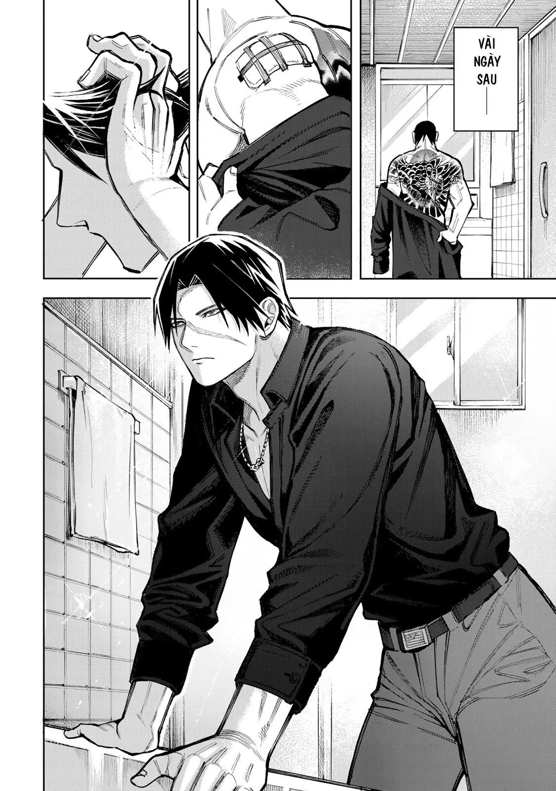 Wound & Bandage Chapter 3 - 2